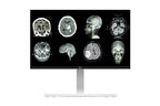 LG 27HJ712C-W 27" 4K Monitor